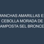 Manchas Amarillas en Cebolla Morada De Amposta Sel Bronce